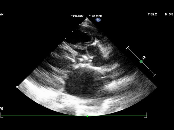 Fetal 2D Echo Test in Kharghar