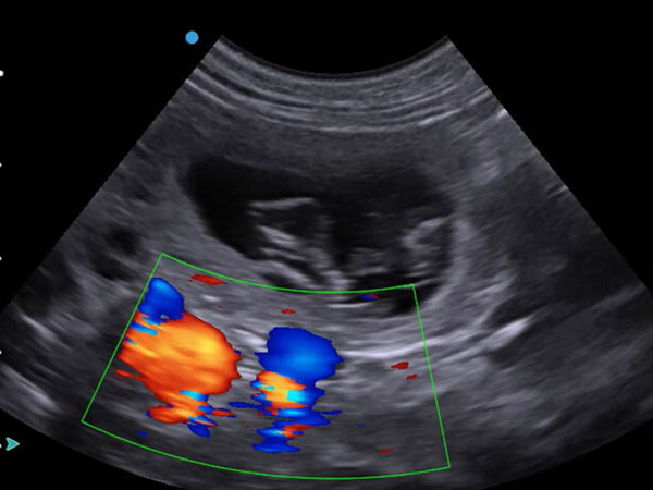 Color Doppler Sonography Centre in Kharghar